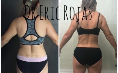 Slim Láser mejora tu cuerpo
