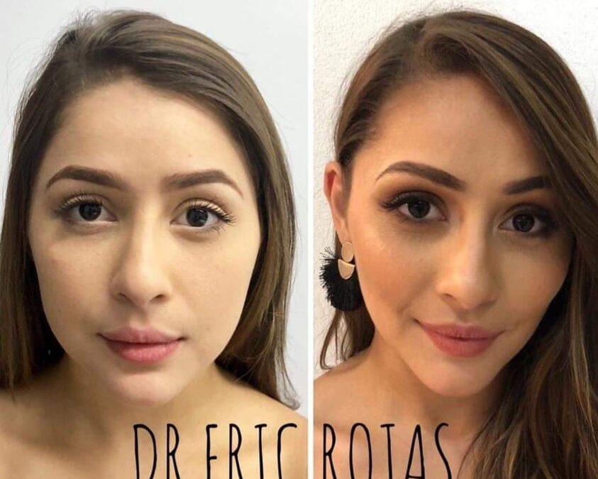 Perfilado de rostro con la mejor técnica.