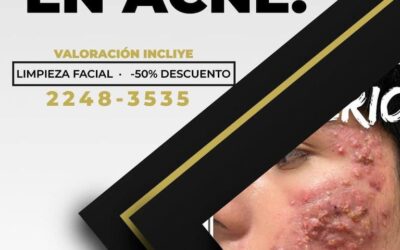 Centro especializado para eliminar el acné de tu vida.