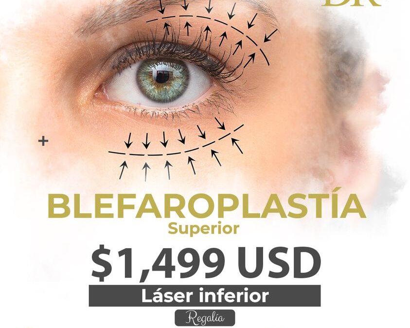 Blefaroplastía con increíble regalía.