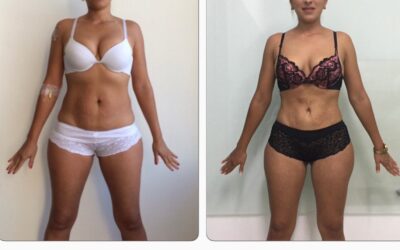 Slim Láser mejora tu cuerpo