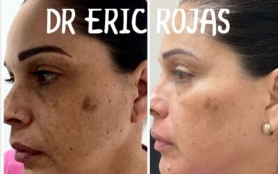 NO MÁS MANCHAS DR ERIC ROJAS 22483535