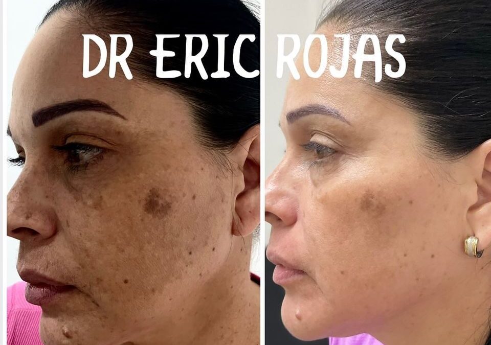 NO MÁS MANCHAS DR ERIC ROJAS 22483535
