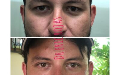 Rejuvenecimiento de rostro, no dudes en visitarnos.