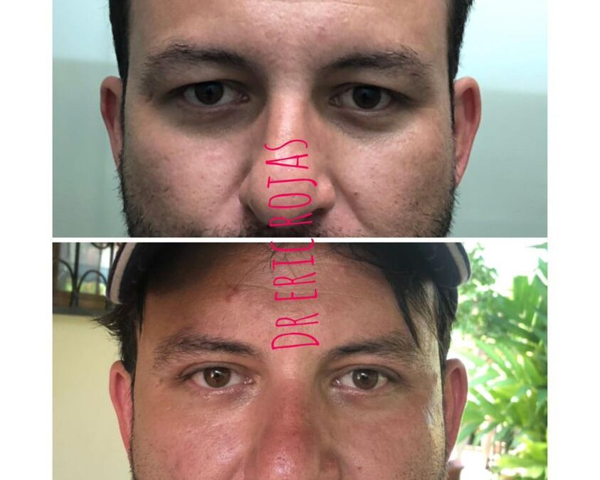 Rejuvenecimiento de rostro, no dudes en visitarnos.