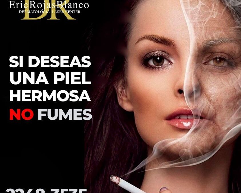 Fumar reduce la elasticidad natural de la piel pues causa la rotura del colágeno y hace disminuir su producción, acelerando así el envejecimiento de la piel!