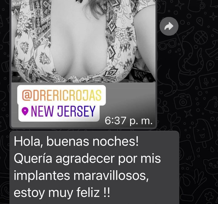 Paciente feliz de su increíble cambio con implantes de senos.