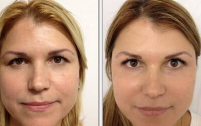 Refrescamiento facial.