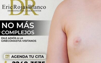 Deja los complejos, trata tu ginecomastia.