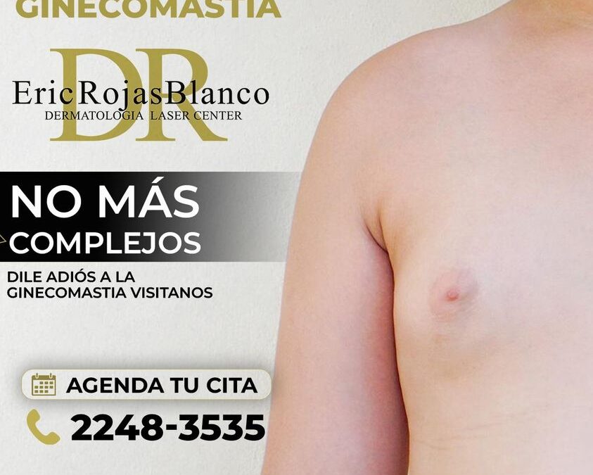 Deja los complejos, trata tu ginecomastia.