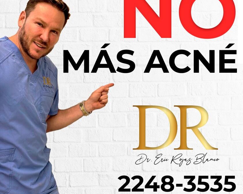 Elimina el acné de tu vida con el mejor tratamiento del país.
