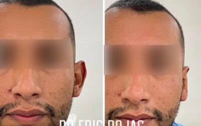 Contamos con la mejor técnica de corrección de orejas.