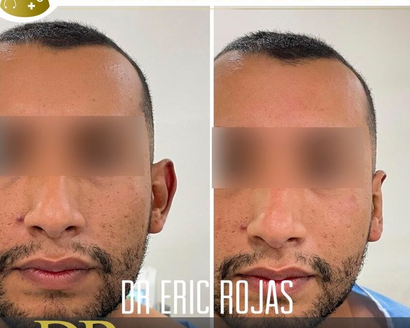 Contamos con la mejor técnica de corrección de orejas.