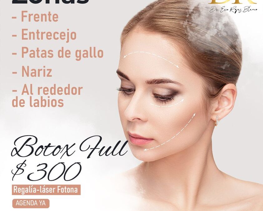 Por el mes de JULIO aprovecha y realiza tu tratamiento de Botox.