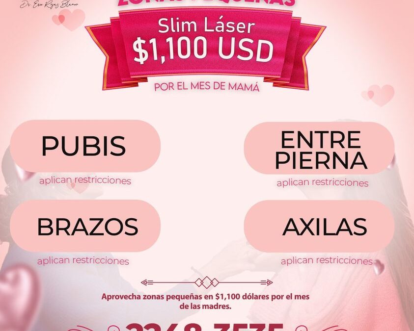 Zonas pequeñas en promoción por el mes de mamá.