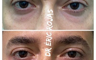 Elimina las ojeras de tu rostro.