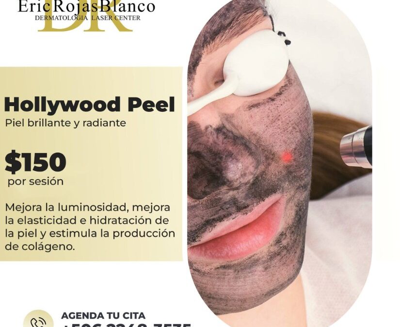 Hollywood Peel para renovar tu piel y quedar perfecta