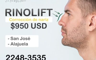 Rinolift es la mejor técnica para corregir tu nariz.