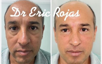 rejuvenece tu rostro con las últimas técnicas.