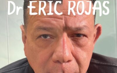 DERMO-OTOPLASTICA DR ERIC ROJAS 22483535 en oferta por este mes 950 dólares