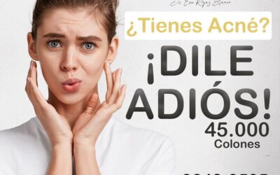 Adiós al acné, nosotros somos los mejores en el área.
