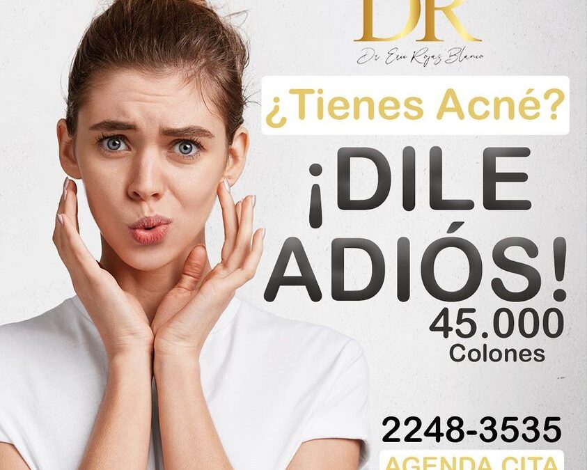 Adiós al acné, nosotros somos los mejores en el área.
