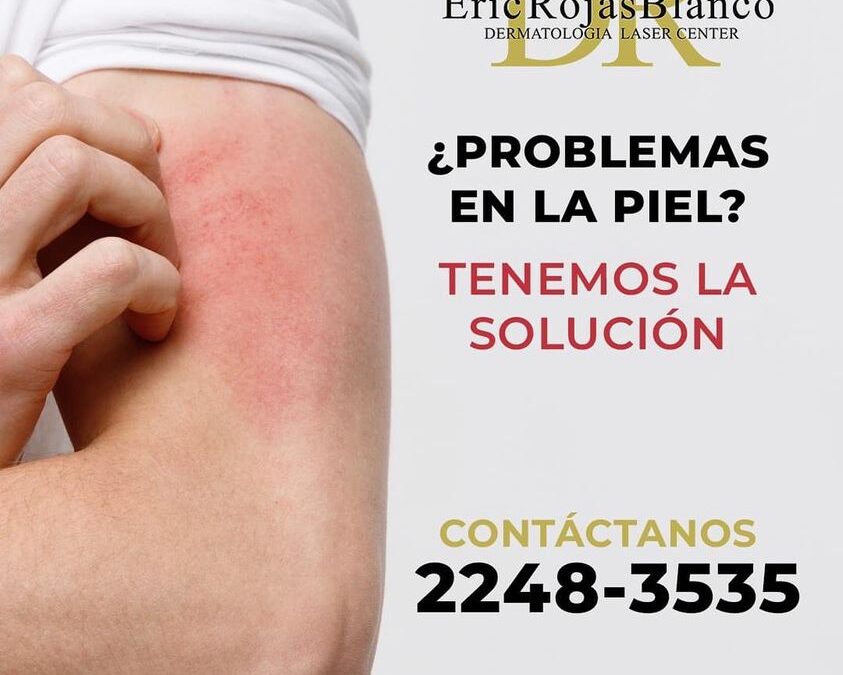 Soluciona tus problemas de piel con los mejores, te esperamos.