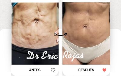Increíble cambio con nuestro láser, búscanos.