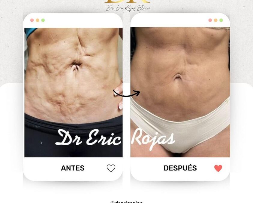Increíble cambio con nuestro láser, búscanos.