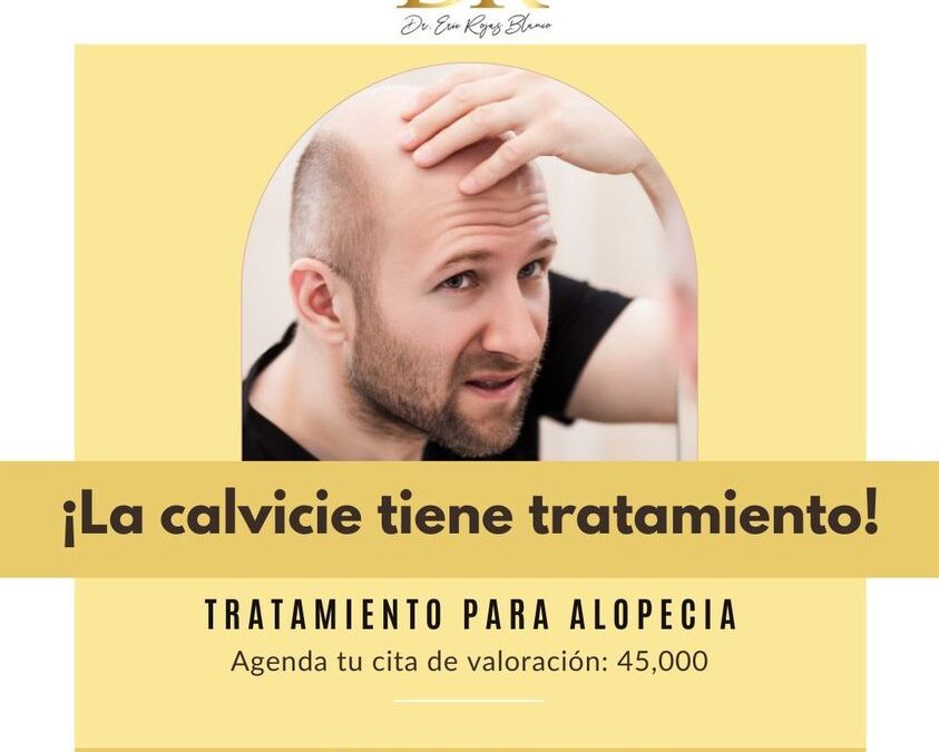 Trata la calvicie, nosotros si solucionamos la alopecia.