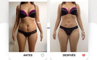 La mejor técnica del país a tu alcance, es Slim Láser.