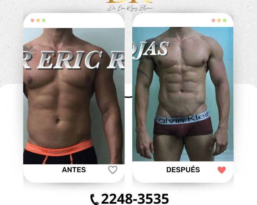 Slim Láser genera el cambio que deseas.