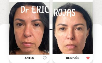 Rejuvenece tu rostro con las últimas técnicas.