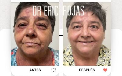 | Tus problemas de piel si tienen solución, nosotros te ayudaremos.