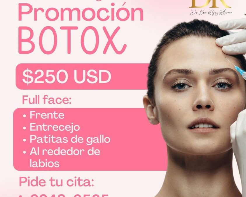 Únicamente el martes 15 de agosto, Botox full face a $250 dólares (10 cupos disponibles)