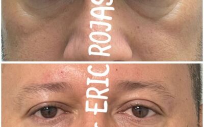 Rejuvenece tu rostro con las mejores técnicas.