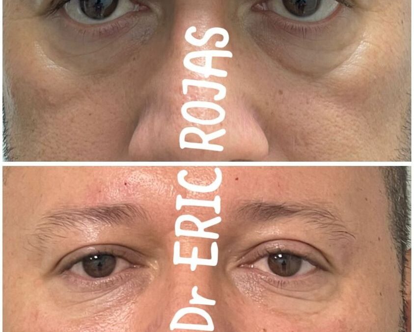 Rejuvenece tu rostro con las mejores técnicas.