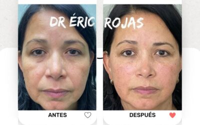 Si necesitas rejuvenecer tu rostro, somos los indicados.