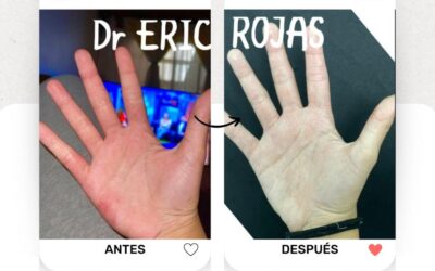 Soluciona tus problemas de piel con los mejores, te esperamos.