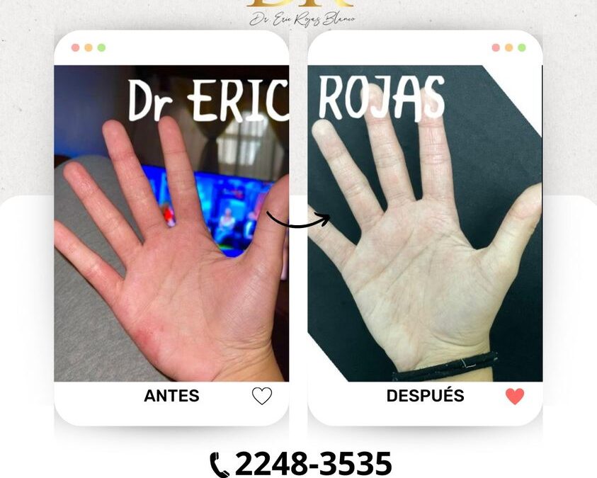 Soluciona tus problemas de piel con los mejores, te esperamos.