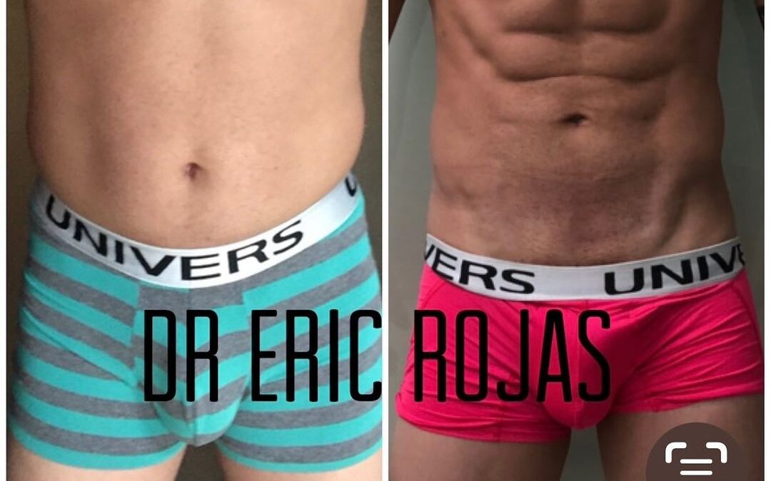 Slim LÁSER DR ERIC ROJAS