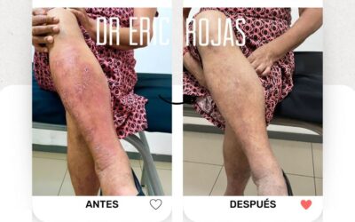 Soluciona tus problemas de piel con los mejores, la mejor opción del país.