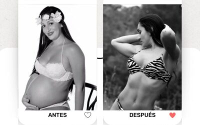 Marcaje Abdominal con Slim Láser, puedes tener el cuerpo que deseas luego de tu bebé.