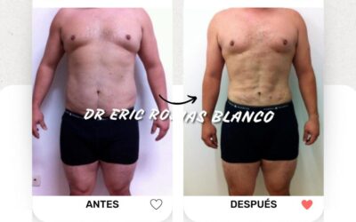 Slim Láser, el mejor método para obtener el cuerpo que deseas.