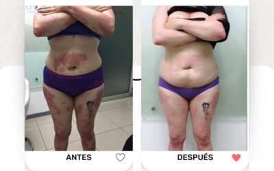 Tus problemas de piel los solucionamos, somos tu mejor opción.