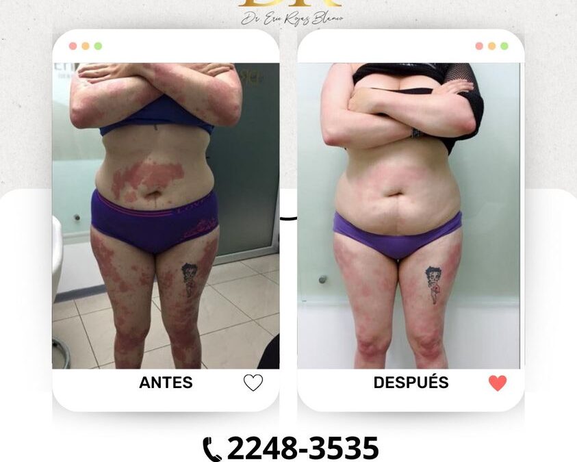 Tus problemas de piel los solucionamos, somos tu mejor opción.