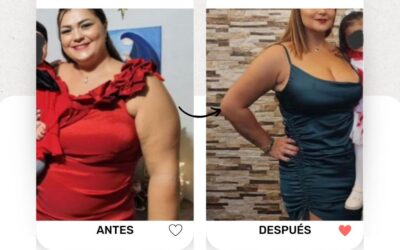 Slim Láser Brazos, resultados increíbles.