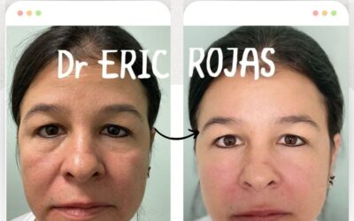 Rejuvenece tu rostro.