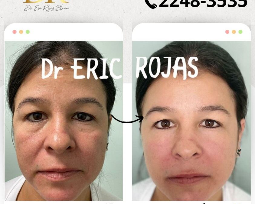 Rejuvenece tu rostro.