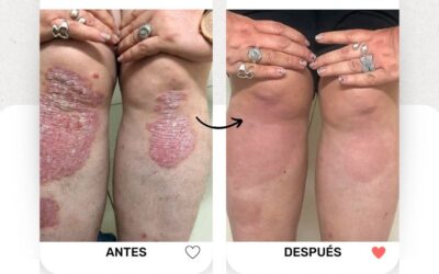 Soluciona tus problemas de piel con los mejores, te esperamos.